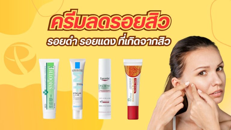 ครีมลดรอยสิว ยี่ห้อไหนดี 2025